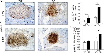 Overexpression of Galectin 3 in Pancreatic β Cells Amplifies β-Cell Apoptosis and Islet Inflammation in Type-2 Diabetes in Mice